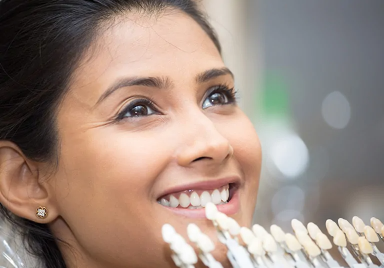 Differences Between Lumineers And Traditional Veneers