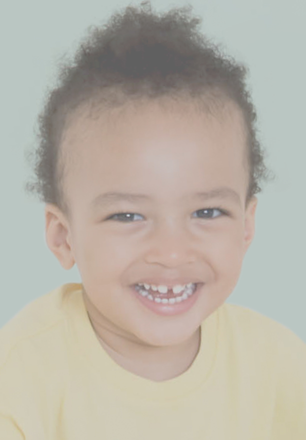 Signs You Might Need A Root Canal And What To Expect